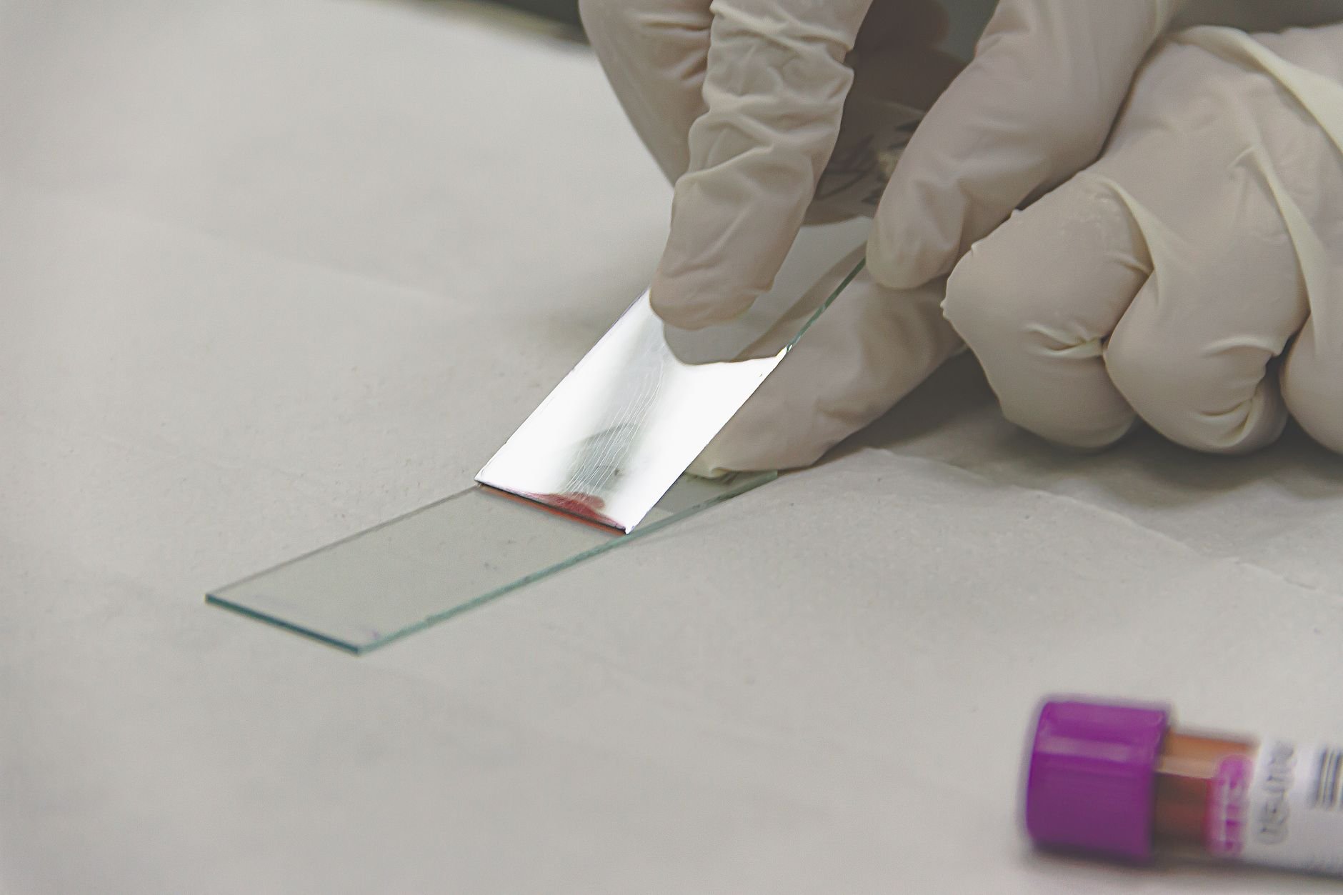 Gloved hands placing a glass microscope slide with a small red smear beside a purple-capped blood collection tube